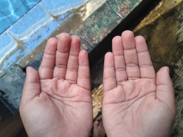 The appearance of hands wrinkled due to cold