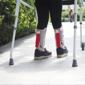 Knee Ankle Foot Orthosis