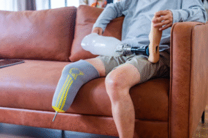 Olahraga yang Aman untuk Pengguna Prostesis