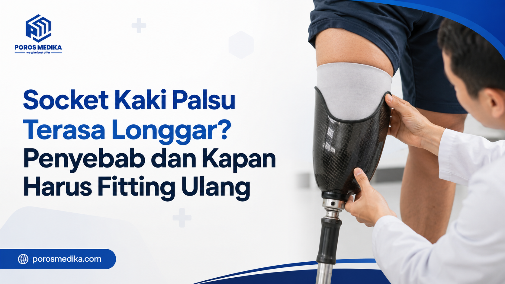 Socket Kaki Palsu Terasa Longgar? Penyebab dan Kapan Harus Fitting Ulang