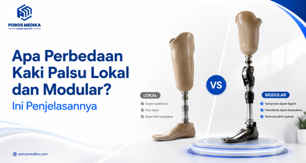 Apa Perbedaan Kaki Palsu Lokal dan Modular? Ini Penjelasannya