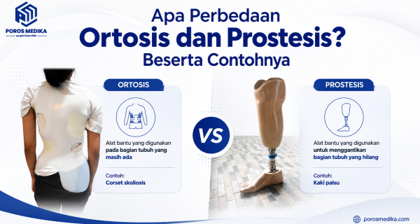 Apa Perbedaan Ortosis dan Prostesis? Beserta Contohnya