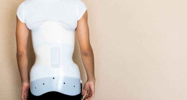 cara ukur brace skoliosis