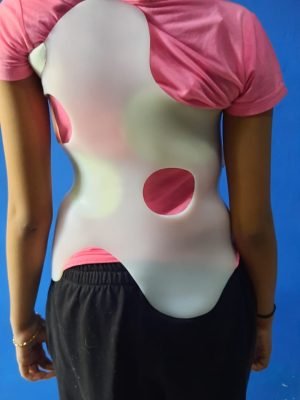 img Skoliosis Brace 5