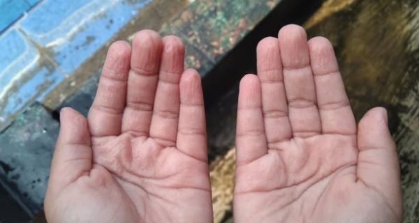 Jual Tangan Palsu Bogor
